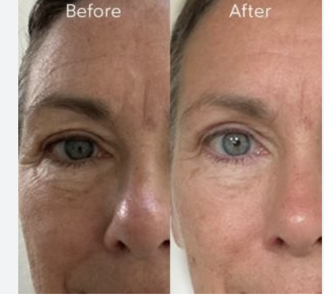 chebula serum before and after - before and after chebula serum - chebula.net